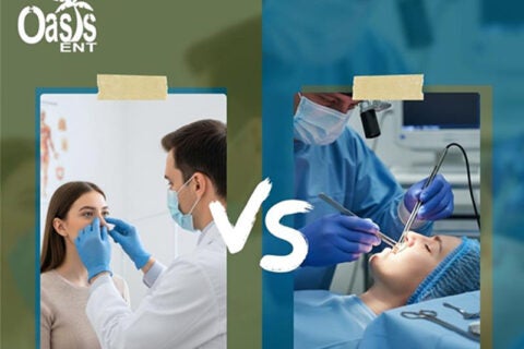 Balloon Sinuplasty Vs. Traditional Sinus Surgery